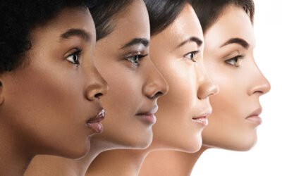 A popular question in Northwood and Rickmansworth –  Which skin type do I have?